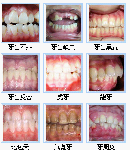 牙齿不齐的原因有哪些