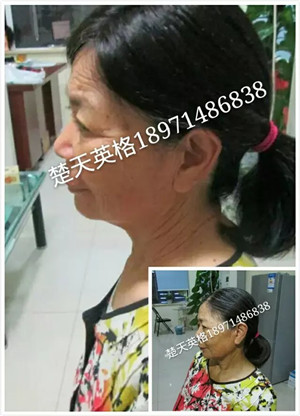 武汉中老年假发遮盖白发假发哪里好?