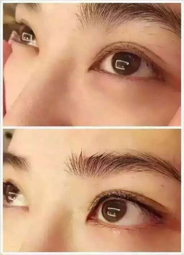 韩式美瞳线多少钱