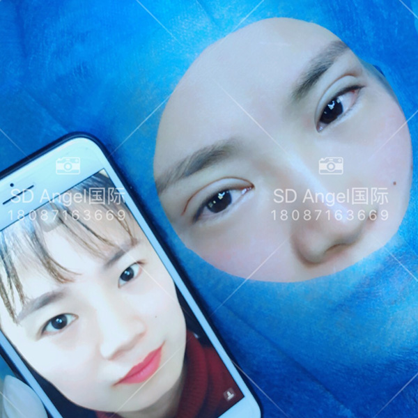 纳米无痕双眼皮课程