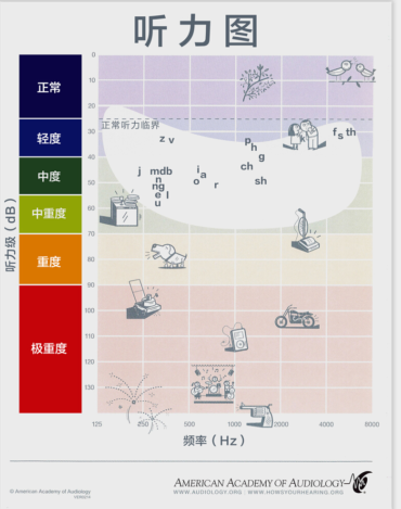 听力图