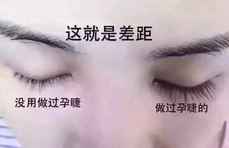 孕睫什么原理_倒睫是什么样子图片(3)